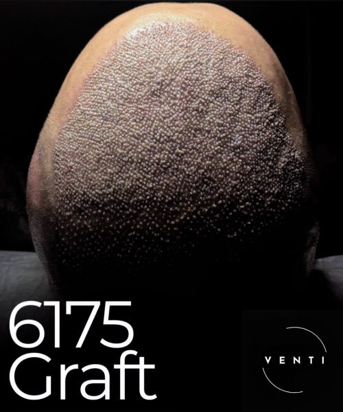 WhatsApp Görsel 2025-10-14 saat 14.30.40_896f33b9